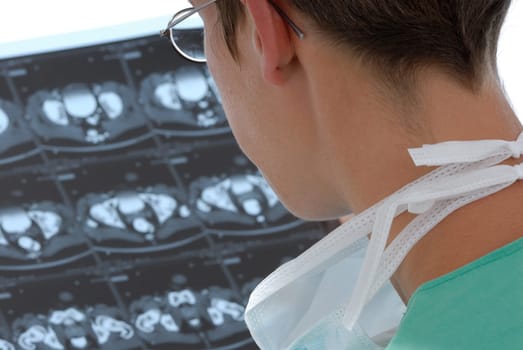 physicians analyzing a radiograph