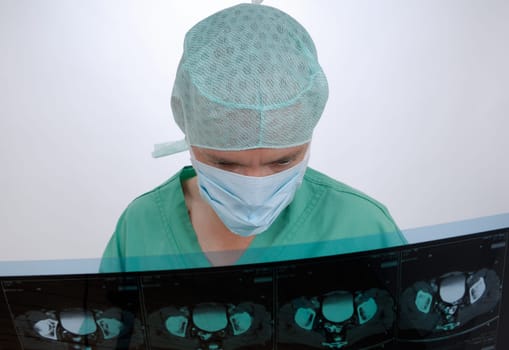 Doctor holds an X-ray