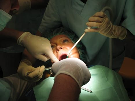 With the agreement of my wife and my dentist,I don't want to withhold such a situation from you. Since I had my doctor's camera,the quality is not quite as high either.