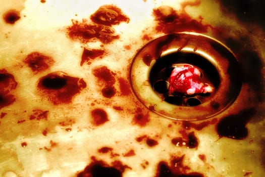 Autopsy