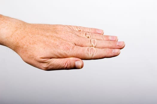 Closed hand