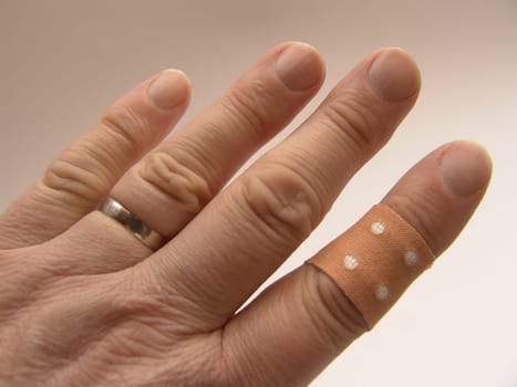 Injury to the finger