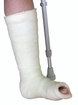 Plaster leg