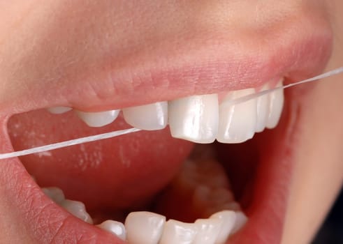 Dental floss