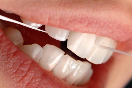 Dental floss