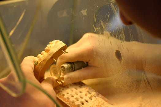 Dental technology,plaster model
