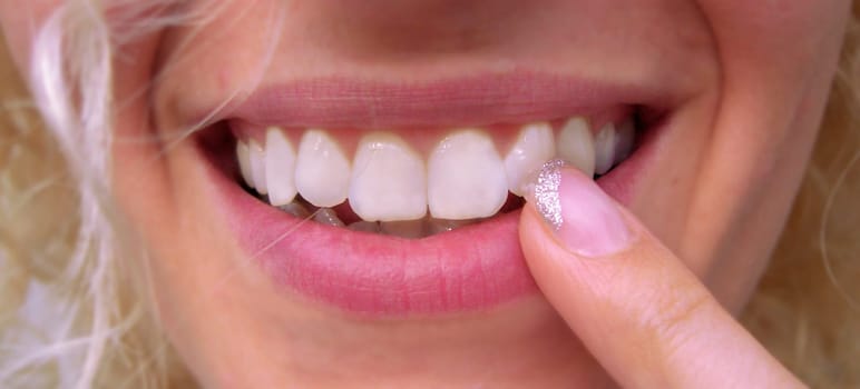 smiles - laugh - Smile - Teeth