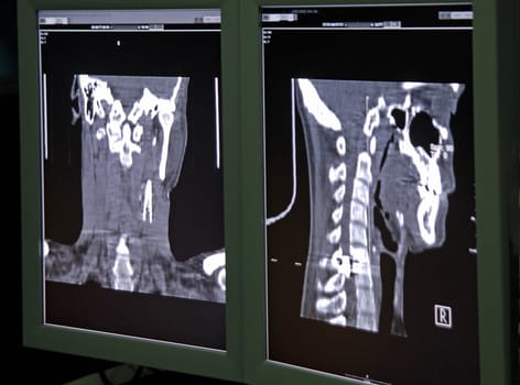 X-ray image shot: