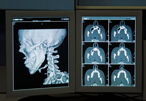 Radiograph
