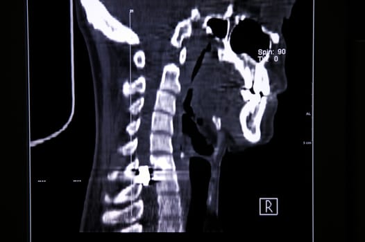 X-ray image shot: