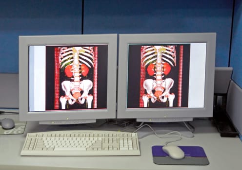 X-ray image in color