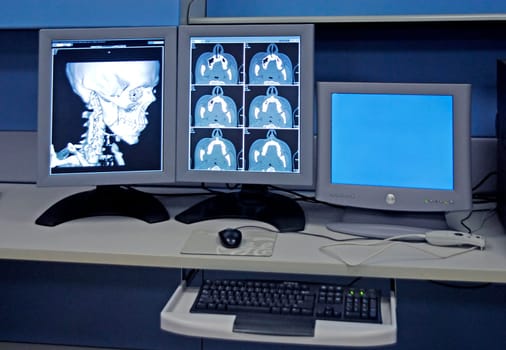 X-rays in the hospital