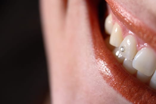 Tooth jewellery - Twinkel