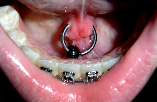 Tongue strap piercing