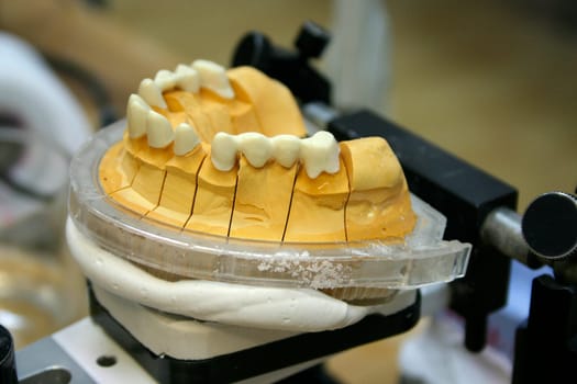 Dental technology