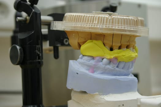 Plaster wax model