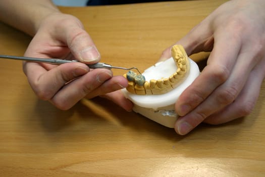 Tooth model of a lower jaw
