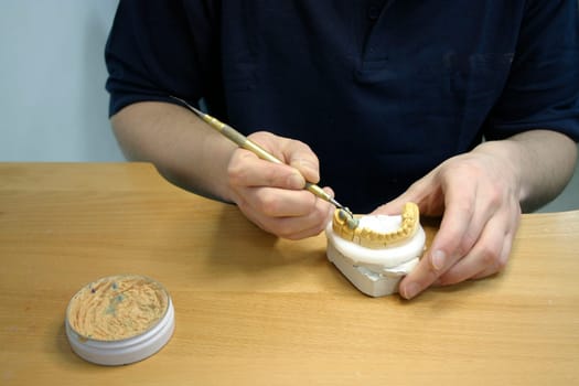 Tooth model of a lower jaw