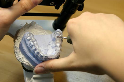 Tooth model of a lower jaw