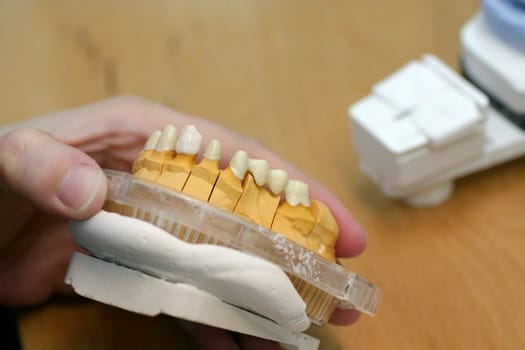 Tooth model of a jaw