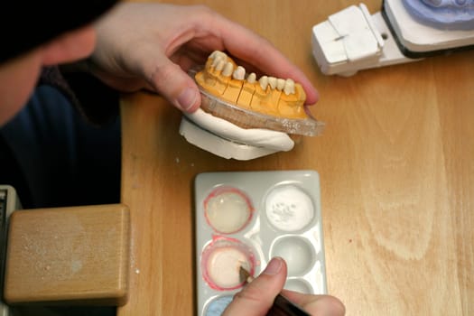 Tooth model of a jaw