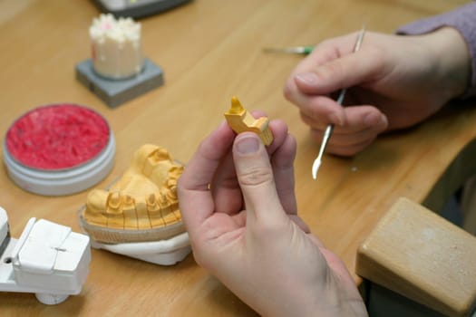 Tooth model