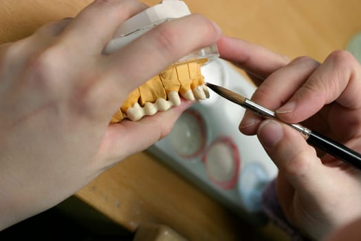 Tooth model of a jaw