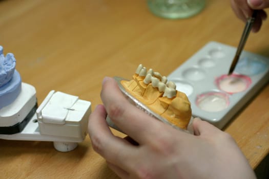 Tooth model of a jaw