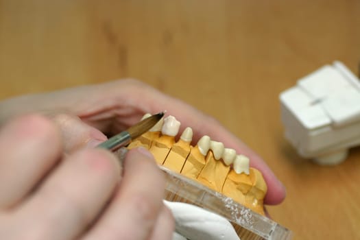 Tooth model of a jaw