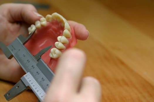 Tooth model of an upper jaw