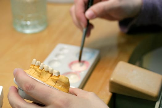 Tooth model of a jaw