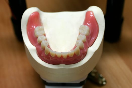 Tooth model of a lower jaw