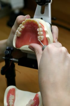 Tooth model of an upper jaw