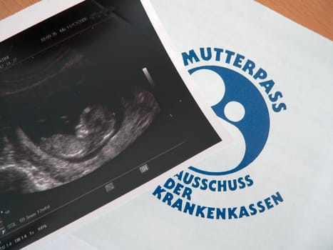 Unborn