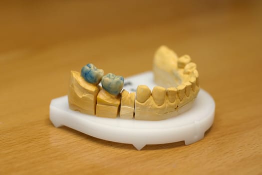 Tooth model