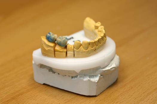 Dentures