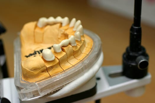 Tooth model