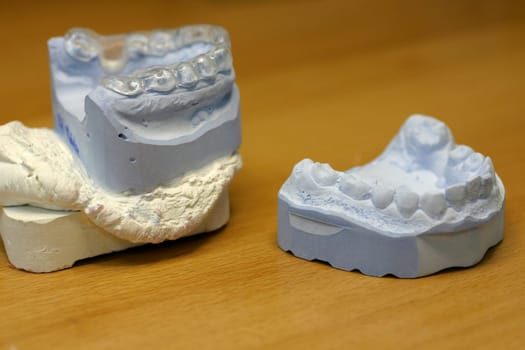Dentures