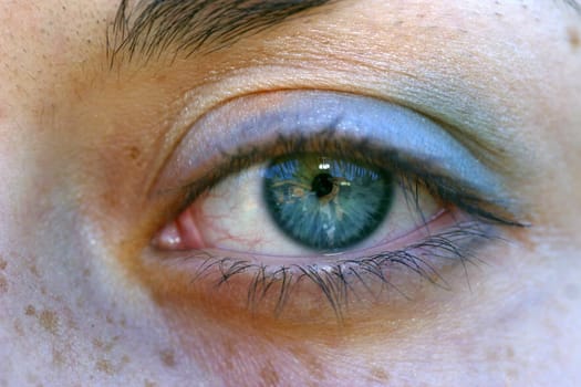 Close-up of a black eye
