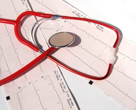 ELECTROCARDIOGRAM
