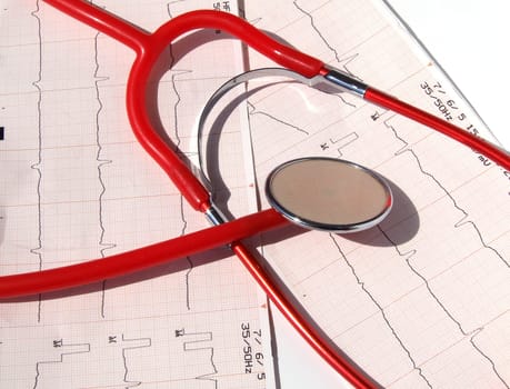 ELECTROCARDIOGRAM