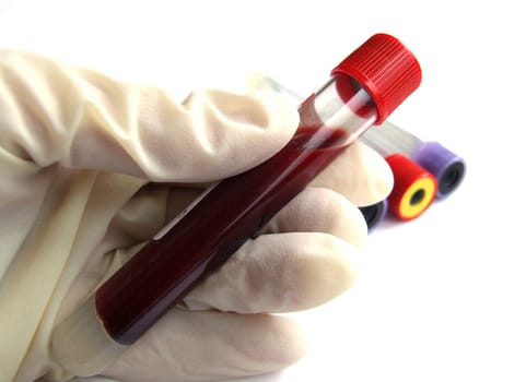 Blood test