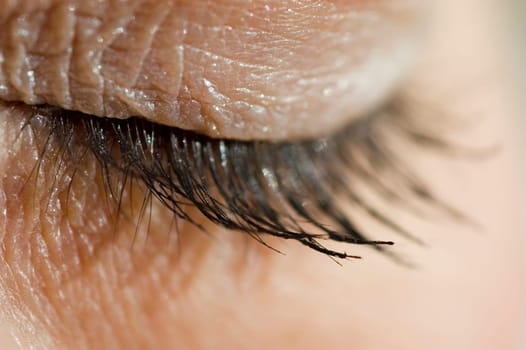 Eyelid
