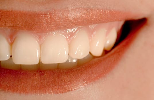 Teeth - Laughter
