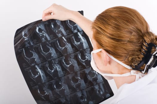 Examine the X-ray image