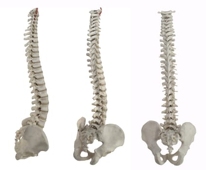 spines