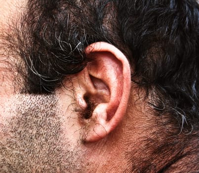 Hairy