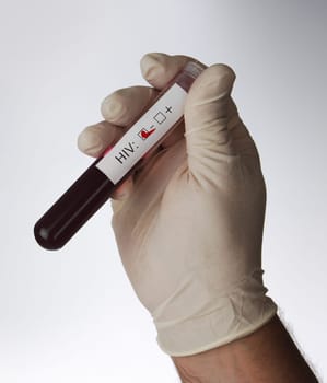 HIV test