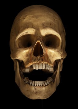 skull