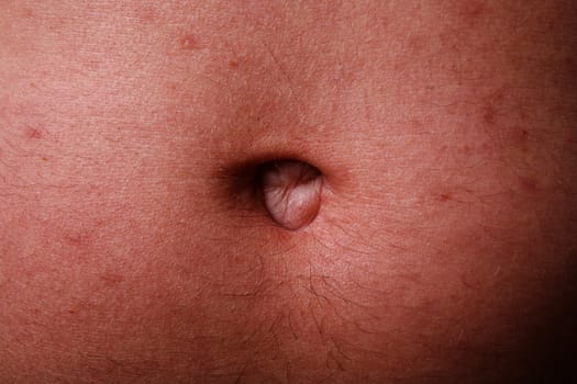 Navel